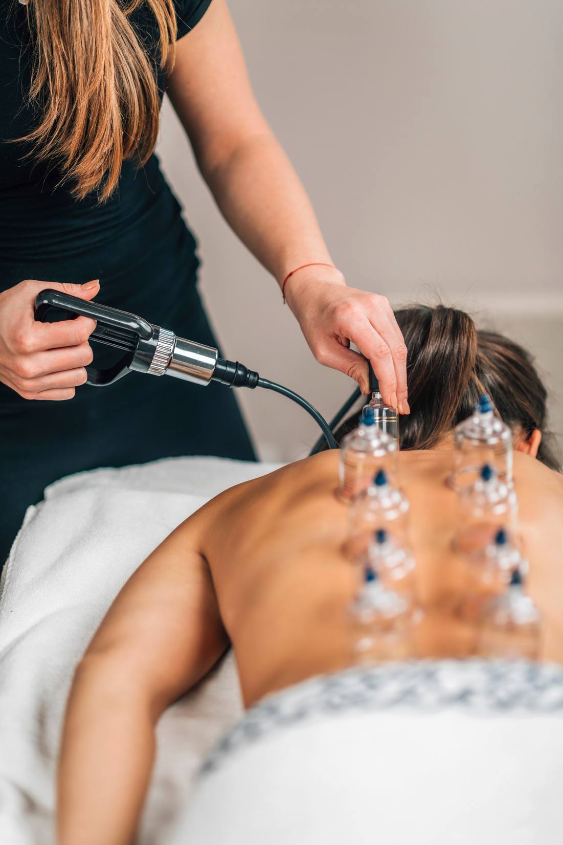 Cupping Therapy - Hijama